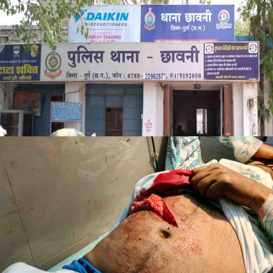 
भिलाई के कैम्प-2 में खौफनाक चाकूबाजी, शादी समारोह में छोटे भाई ने बड़े भाई पर किया जानलेवा हमला
