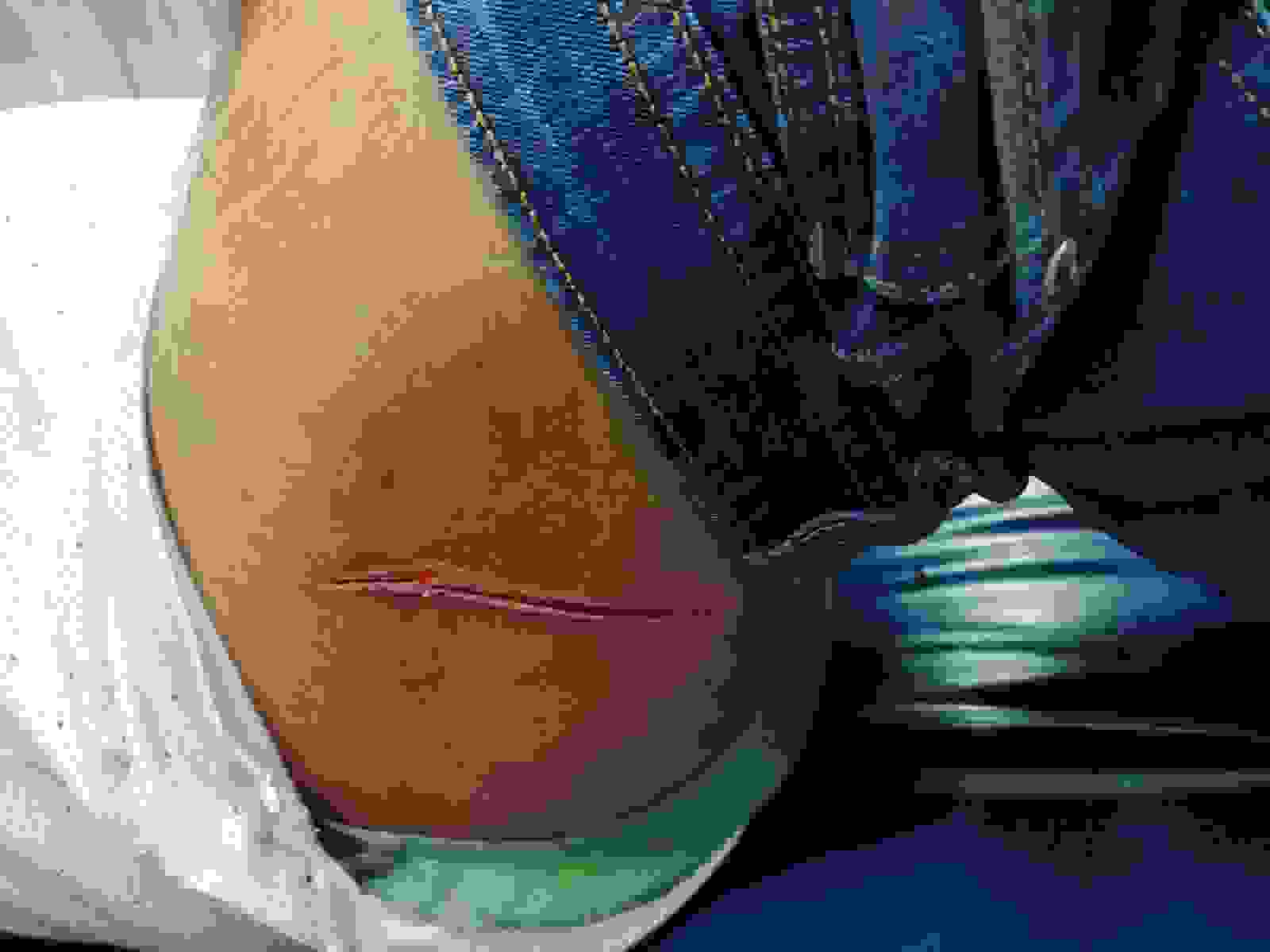 भिलाई में एमडी बंगला के पास युवक को मारा चाकू, उधर राजधानी में पुलिस ने निकाला चाकूबाजों का जुलूस